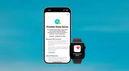 Apple Watch erhält kanadische Zulassung für die Erkennung von Schlafapnoe