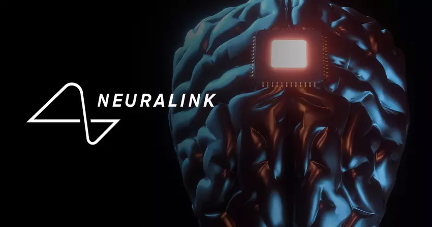 Ausweitung des Neuralink-Programms: Freiwillige aus aller Welt können sich jetzt für die Implantation des innovativen Neurochips bewerben
