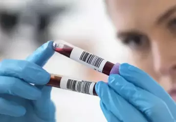 Chinesische Wissenschaftler entwickeln AI-Bluttest, der Krankheiten ...