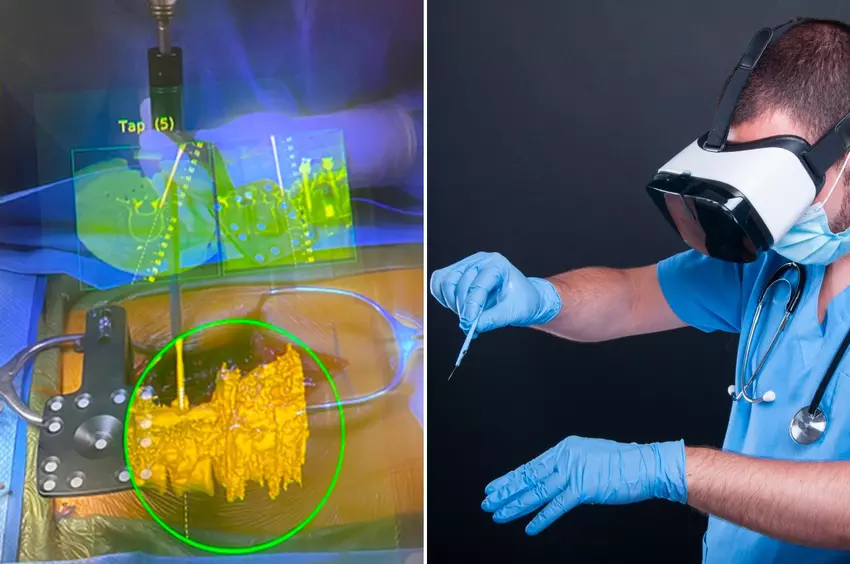 Das Metaverse hat die Macht, die Gesundheitsversorgung zu verbessern, und es hat bereits begonnen