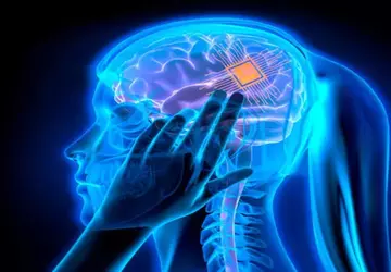 Science-Fiction ist Wirklichkeit geworden! Ein Neuralink-Chip ...