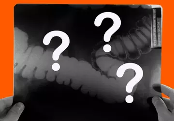 Ärzte, die KI-Geräte verwendet haben, verlieren ...