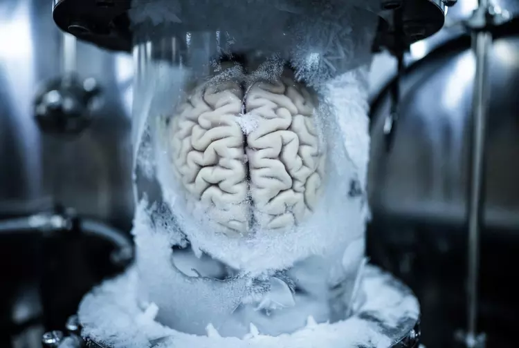 Kryonik für Einsteiger: Wie man ein ...