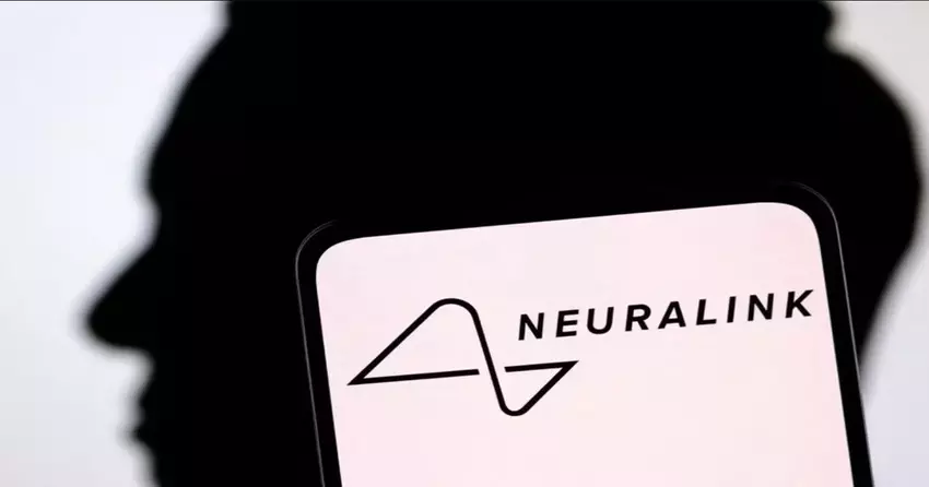 Erster Neuralink-Patient, der eine Computermaus mit seinen Gedanken steuern kann