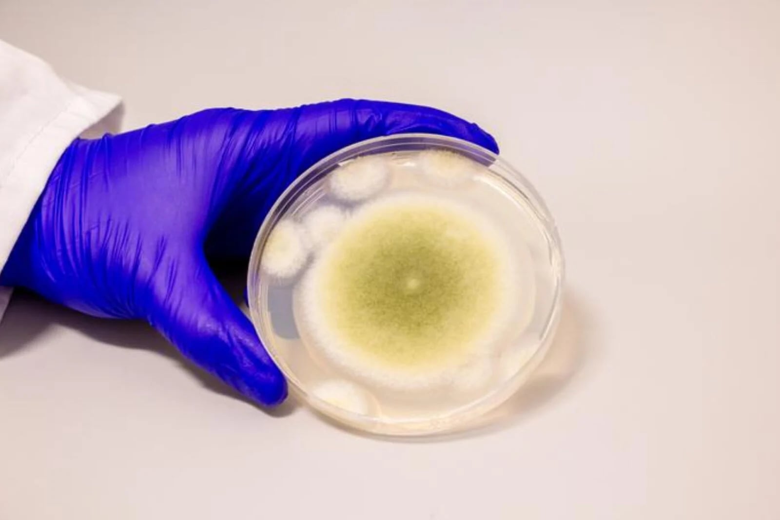 Aspergillus flavus: potenzielle Innovationen und Gesundheitsrisiken Aspergillus flavus: ein Pilz mit technologischem Potenzial und Herausforderungen